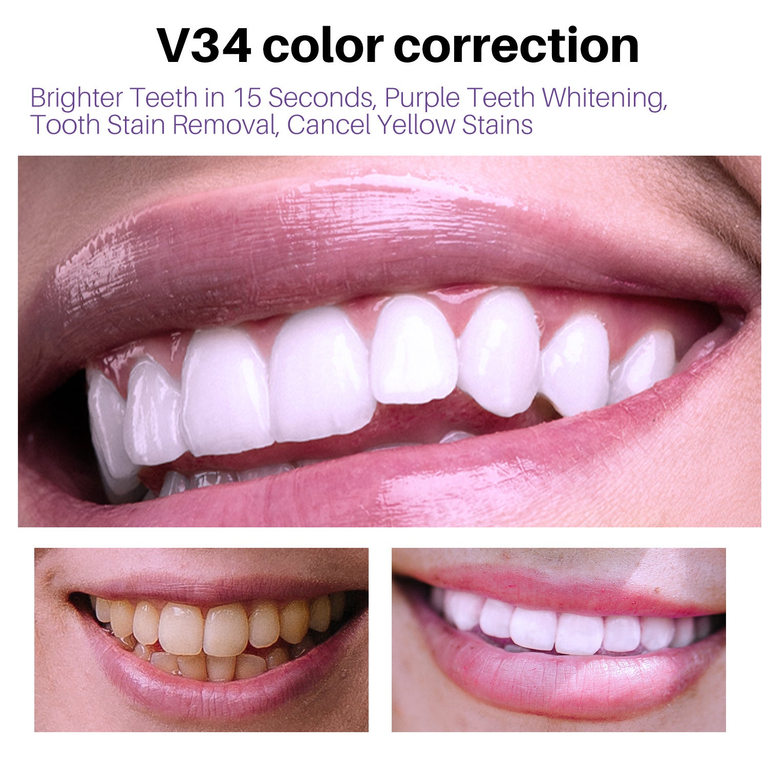 Lanthome V34 Teeth Whitening Mousse for Oral Care - VaultDigital
