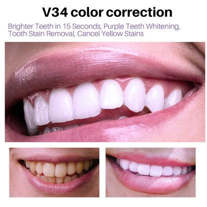 Lanthome V34 Teeth Whitening Mousse for Oral Care - VaultDigital