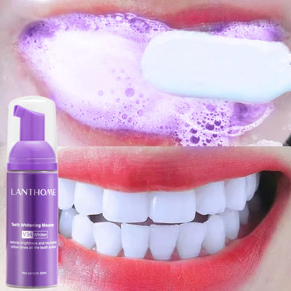 Lanthome V34 Teeth Whitening Mousse for Oral Care - VaultDigital