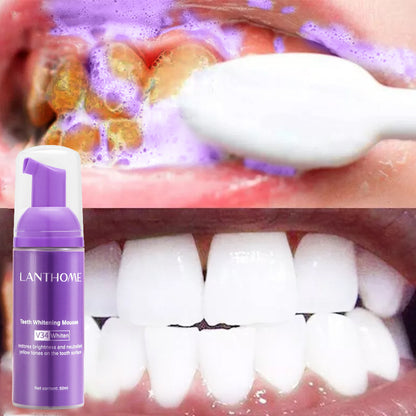 Lanthome V34 Teeth Whitening Mousse for Oral Care - VaultDigital